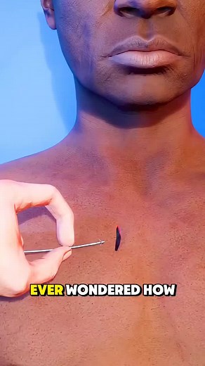 How a Pacemaker Is Installed ❤️⚡ Inside the Life-Saving Heart Procedure Is Done (3D Animation) #pacemaker #cardiacsurgery #hearthealth #medicalprocedure #lifesavingtechnology