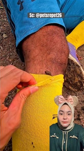 Lintah dalam Kaos Kaki ‼️ petsrepet26