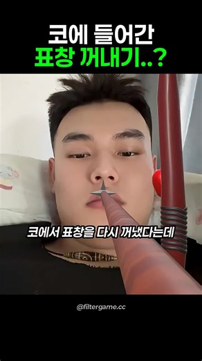 코에 들어간 표창을 꺼내는 방법과 게임
