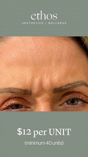 1.6K views |  Sparta  New Patient Special Botox: $12/Unit (Reg....