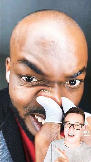 CRAZY BLACKHEAD REMOVAL - I Didnt Know This Was Possible #shorts