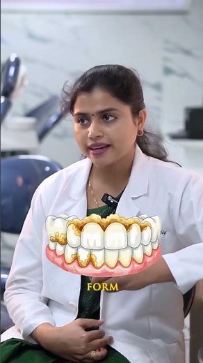 Why Are My Teeth Getting Stained? 🦷✨