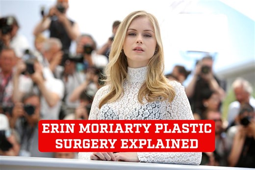 Erin Moriarty plastic surgery rumors explained