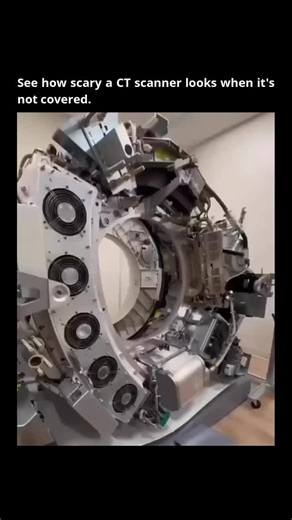 Remarkable Facts on Instagram: "Follow @remarkable.facts if you want to get smarter every day. -------------- This visual offers an unfiltered glimpse into the intricate engineering of a computed tomography (CT) scanner, stripped of its protective outer casing. The exposed components reveal a sophisticated array of high-voltage systems, delicate sensor arrays, and powerful X-ray tube assemblies, starkly contrasting with its familiar, sleek medical presentation. This internal architecture highlig