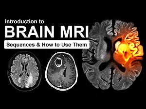 Introduction to Brain MRI: Routine Sequences and How to Use Them