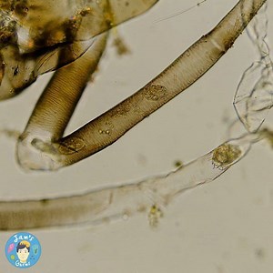 38 reactions · 4 comments | This is life inside a bug exoskeleton!...