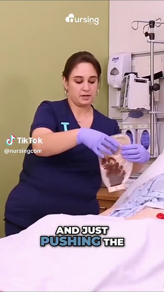 How to Clean and Assess a Stoma | Nursing Skills #nursingskills #woundcare #happynursing #futurenurse #nursingcom #lpnstudent #lpn #lpntorun #rnstudent #nursingschoolproblems #nursingnotes #studentnurse #nursingstudents #nursingschool