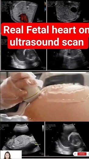 Real Fetal Heart Ultrasound Scan ❤️ | Baby’s Heartbeat Inside the Womb #Shorts