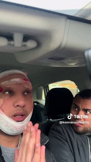 Fake Face Plastic Surgery Prank on Baba | Couples Comedy