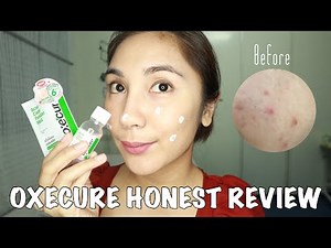 OXECURE REVIEW | Yna Parulan