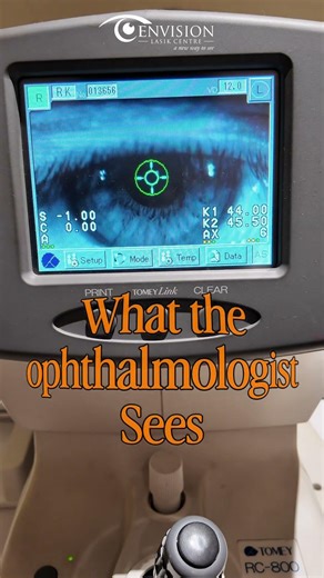 POV : What patients see vs What an ophthalmologist sees | Dr Advaith | Hyd #envisionlasikcentre