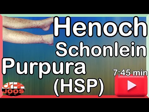 Henoch Schonlein Purpura (HSP) ׀ Basic necessary facts & management ׀ Made easy - dr joos