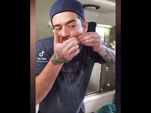 ⚠️EXTREME PIMPLE EXPLOSION TIK TOK COMPILATION 2021!
