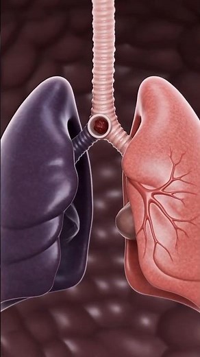This Clot Travels From Your Leg to Your Lungs