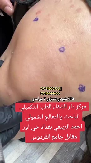 #احمد_الربيعي #مركز_دار_الشفاء_للطب_التكميلي #علاج_طبيعي #تأهيل #CapCut #التهاب_العظم #هاشتاك #شهر #كايروبراكتيكchiroprctic #كايروبراكتيك #عظام_ومفاصل #علاج_بالاعشاب #علاج_بالاعشاب