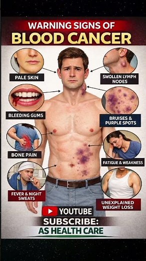Warning Signs of Blood Cancer You Must Not Ignore 🚨#blood cancer #csnsersigns#healthylifestyle