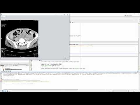 Extracting images from DICOM files | DICOM 3