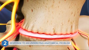 If you experience a back muscle spasm, your back may be warning you about a serious underlying issue with your spine. Watch the entire video here: http://bit.ly/muscle-spasm | Spine-health