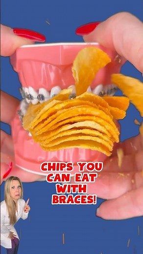 CHIPS YOU CAN EAT WITH BRACES 🥔 🦷