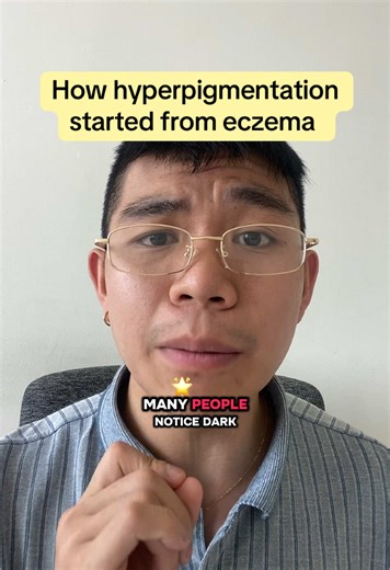 Fix Your Skin Barrier Issues Related to Eczema