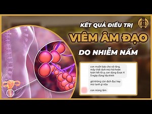 Nguyên Nhân - Triệu Chứng Và Cách Điều Trị Viêm Âm Đạo Do Nhiễm Nấm Candida | Tuệ Y Đường