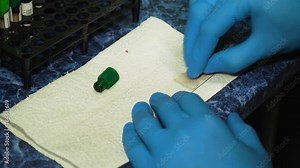 Slide peripheral blood smear method. Doctor examines and analyzes blood samples in the laboratory