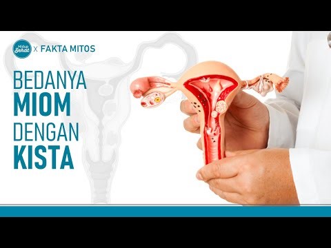 Begini Cara Membedakan Miom dengan Kista | Hidup Sehat tvOne
