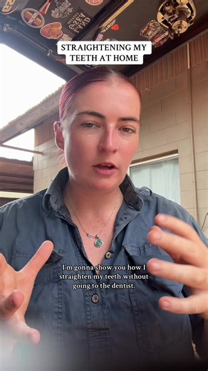 I went with @bitesoft and so far the process has been simple! #clearaligners #teethstraightening #bitesoftdental #teethjourney #outbackaustralia