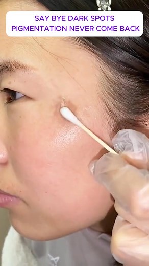 Freckles making you self-conscious in photos? 😩 This Vitamin C Essence fades spots fast—melts melanin, evens tone. Sarah (28) saw smoother, brighter skin in days! Lightweight, absorbs in 3s—no greasiness under makeup. 96% noticed better results than harsh serums. Click to glow! 🍊https://www.calglint.com/products/vitamin-c-whitening-freckles-essence #FreckleFade #LuminousSkin | Reality Fatal-C1