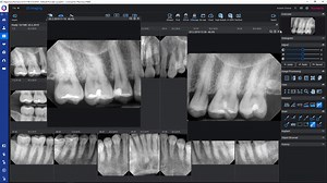 How to – Move, swap, and view 2D images with study templates in Planmeca Romexis