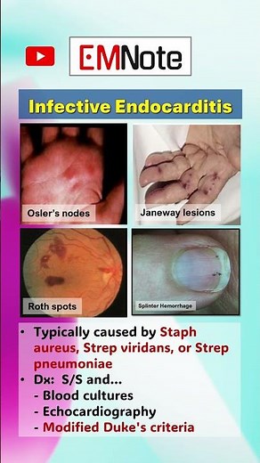 Infective Endocarditis #doctor #medical #nursing