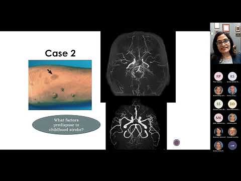 Pediatric Strokes: 6 Illustrative Cases and Insights | Lalitha Sivaswamy, MD