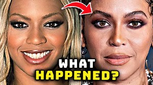 871K views · 4.6K reactions | Beyoncé's Face - Before and After. #beyonce | FTD News | Facebook
