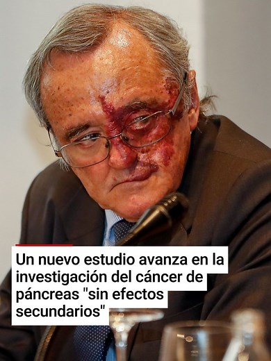 Investigación promete cura para tumores de páncreas