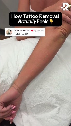 Does Tattoo Removal Hurt? #removery