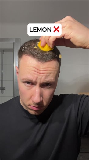 Miraj: The anti-baldness solution