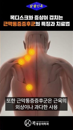 Treatment for Myofascial Pain Syndrome with Symptoms Overlapping with Herniated Discs!