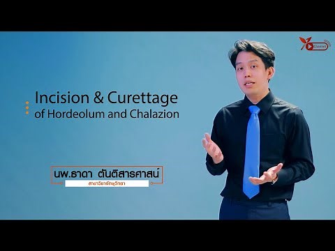 Incision and Curettage of Hordeolum and Chalazion
