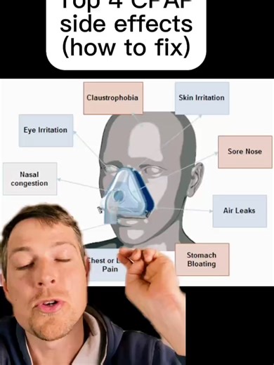 The 4 most common CPAP side effects — and how to actually fix them. (Tap @apneareset to get your clear, personalized path to better sleep) CPAP works — but only if you handle the side effects correctly. Here’s what’s really going on, and what to do next. 1️⃣ Dry mouth If your mouth falls open, pressurized air dries everything out. Nasal breathing keeps moisture where it belongs. That’s why gentle nasal training — and safe mouth taping guidance — matters. 2️⃣ Air in the stomach Too much pressure 