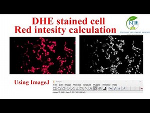 How to Analyze DHE Red Fluorescence in ImageJ | Oxidative Stress Marker Quantification