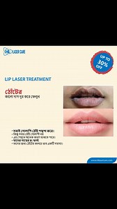 HL Laser Care on Reels | Facebook