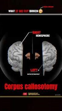 Can Split Brain Work?🤯 ‪@ProfessorOfHow‬ ‪@dhruvrathee‬ ‪@FactsMine‬ ‪@FactoHolic‬ #3d #3danimation
