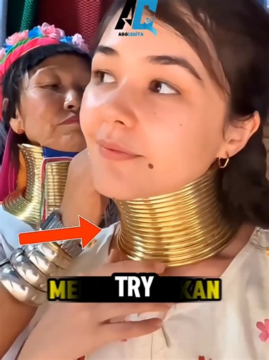 The Dangers of Wearing Neck Rings: Insights and Perspectives