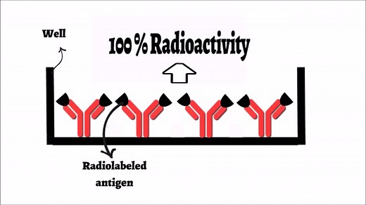 RadioImmunoAssay| The Principle And Procedure Of RIA