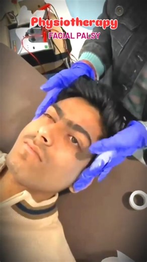 facial palsy treatment #bells palsy#paralysis #mst machine #physiotherapy #short