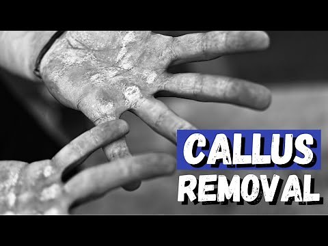 Hand Callus Removal | Get Rid of that Hard and Rough Skin!