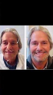 Before & After Deep Plane Facelift: Natural Results & Expert Technique | Dr. Sam Rizk