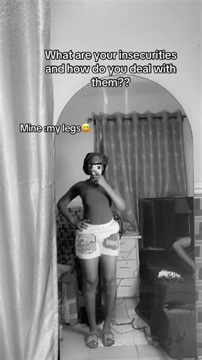 Embracing Insecurities: My Journey with Bow Legs