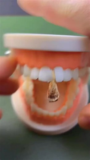 Expert Teeth Repair Services at Skin City Clinic