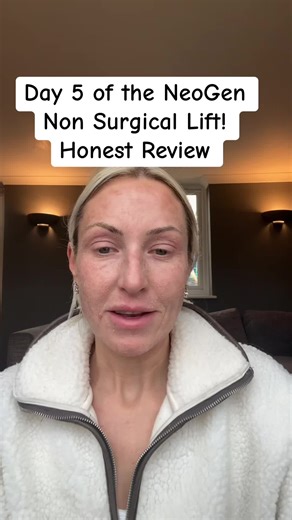 Day 5 of my NeoGen skin recovery journey. The tightness and dryness are starting to calm down and my skin is beginning the deeper rebuilding stage. This is the phase where new collagen activity is starting underneath the surface, which is why the real results from this treatment develop slowly over the next few months. What’s fascinating is that the skin doesn’t just recover it keeps renewing itself over time. Many people notice their skin continuing to improve in texture, firmness and overall g